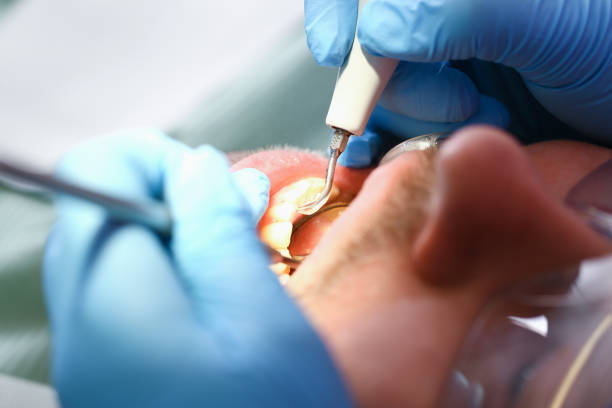 Best Emergency Cosmetic Dentistry in Chigan Center, MI
