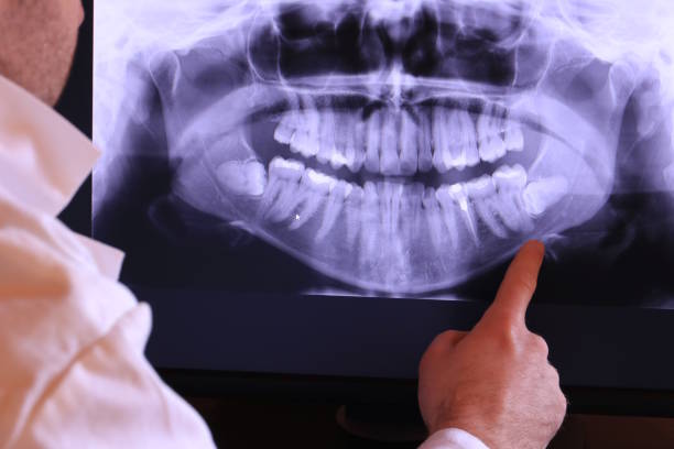 Best Broken or Cracked Tooth Emergency Dentist in Chigan Center, MI
