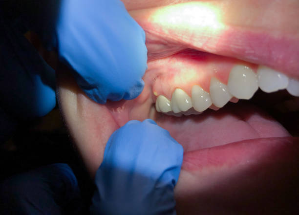 Best Broken or Cracked Tooth Emergency Dentist in Chigan Center, MI